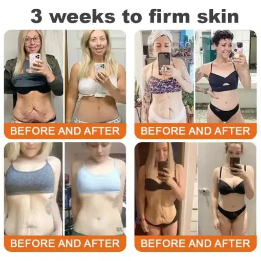 👨⚕️ Made and Shipped from US✅ Tlopa® Bee Venom Multi-Symptom Skin Treatment Cream